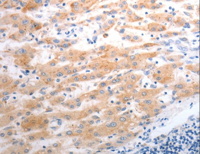 Polyclonal Rabbit anti-Human SLC22A6 / OAT1 Antibody (IHC, WB)