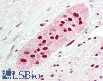IHC-plus™ STK36 Antibody (aa373-422)