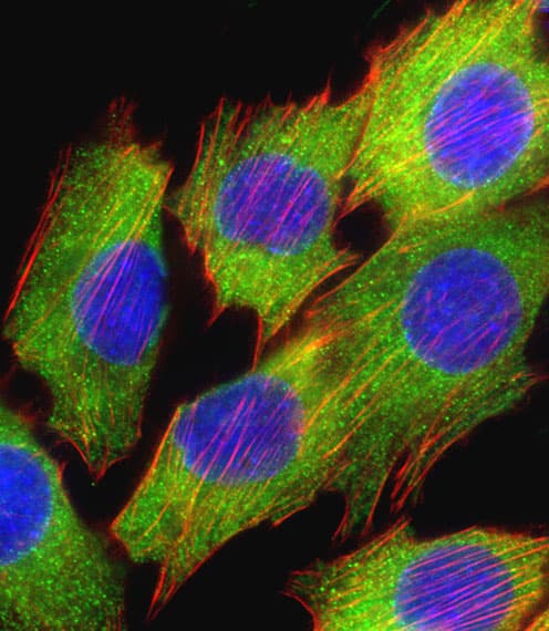 AKT2 Antibody (Ser474)