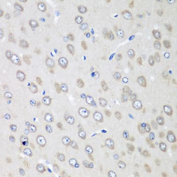 Polyclonal Rabbit anti-Human RPN2 / Ribophorin II Antibody (IHC, WB)