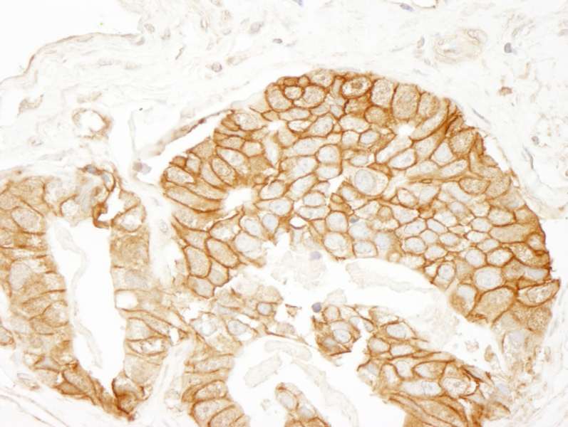 CTNNB1 / Beta Catenin Antibody (aa760-781)