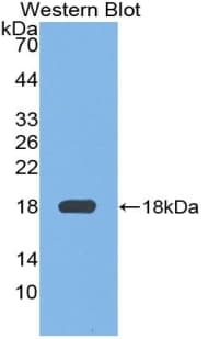 FN1 / Fibronectin Antibody (aa2117-2236, PE)