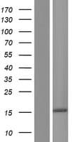 NANOS2 / NOS2 Protein (Over-Expression Lysate Myc-DDK (Flag))