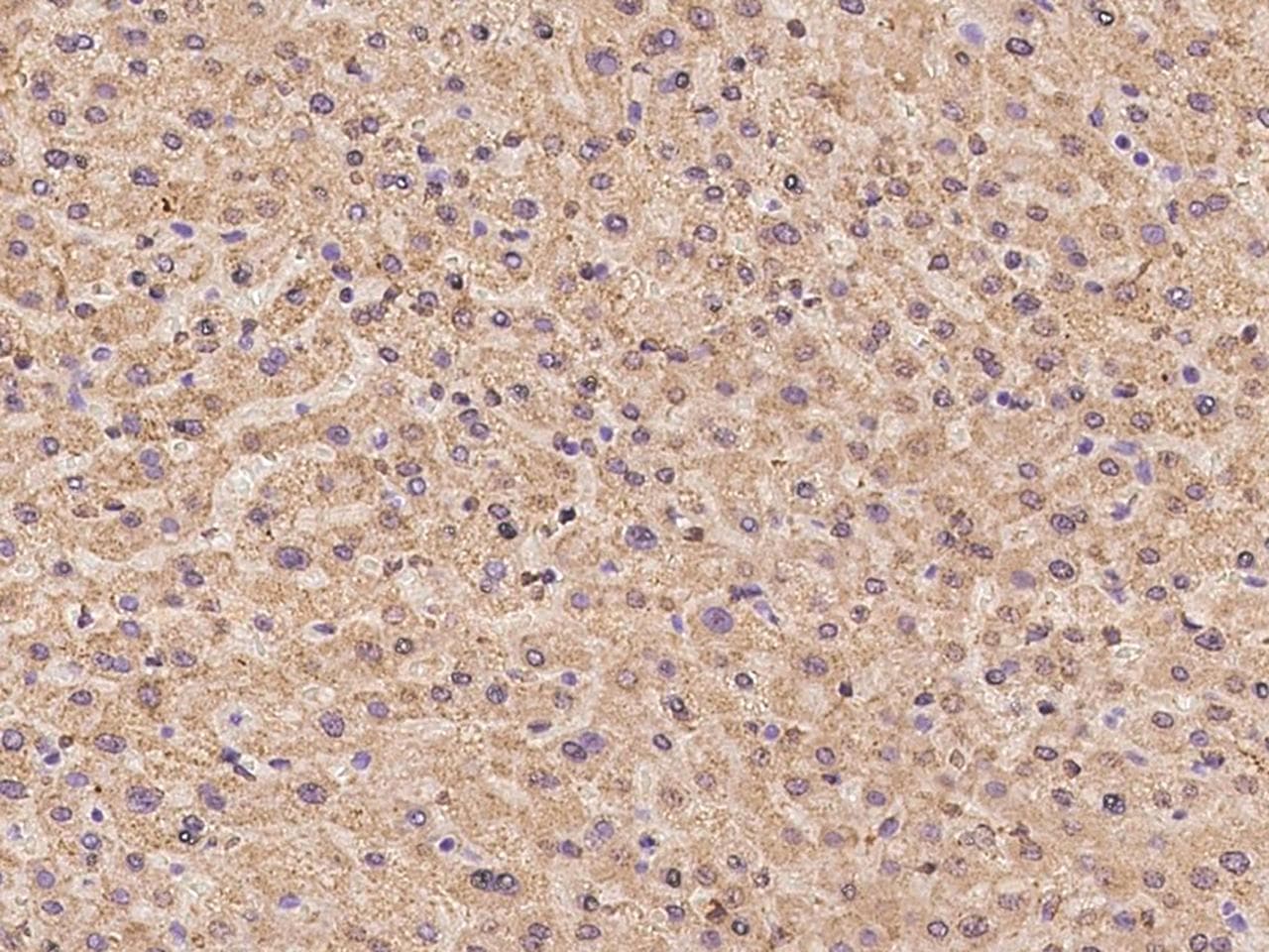 ALDH6A1 Antibody