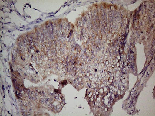 GPR49 / LGR5 Antibody (aa22-543, clone UMAB210)