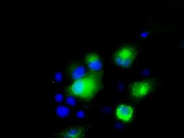PMEL / SILV / gp100 Antibody (clone OTI7B2)