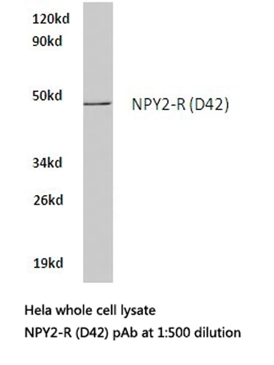 NPY2R Antibody (Asp42)