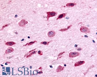 PathPlus™ Polyclonal Rabbit anti-Human NEK9 Antibody (Kinase Domain, IHC)
