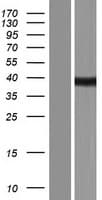 SPT3 / SUPT3H Protein (Over-Expression Lysate Myc-DDK (Flag))