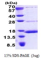 Human NDUFS6 Protein (Recombinant His)