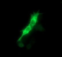 FAK / Focal Adhesion Kinase Antibody (clone OTI4A8)