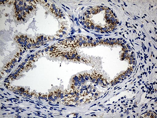 CCDC22 Antibody (clone OTI5C1, Carrier-free)