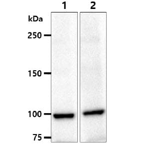 ACTN1 Antibody (clone AT1D10)