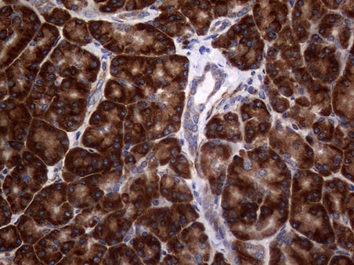 Monoclonal Mouse anti-Human DIRAS2 Antibody (clone OTI8A5, aa1-196, IHC, WB)