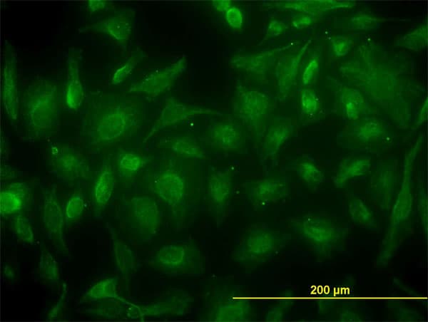 Monoclonal Mouse anti-Human CKB / Creatine Kinase BB Antibody (clone 3D5-3D11, IF, WB)
