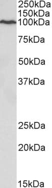 IHC-plus™ VCP Antibody (Internal Region)