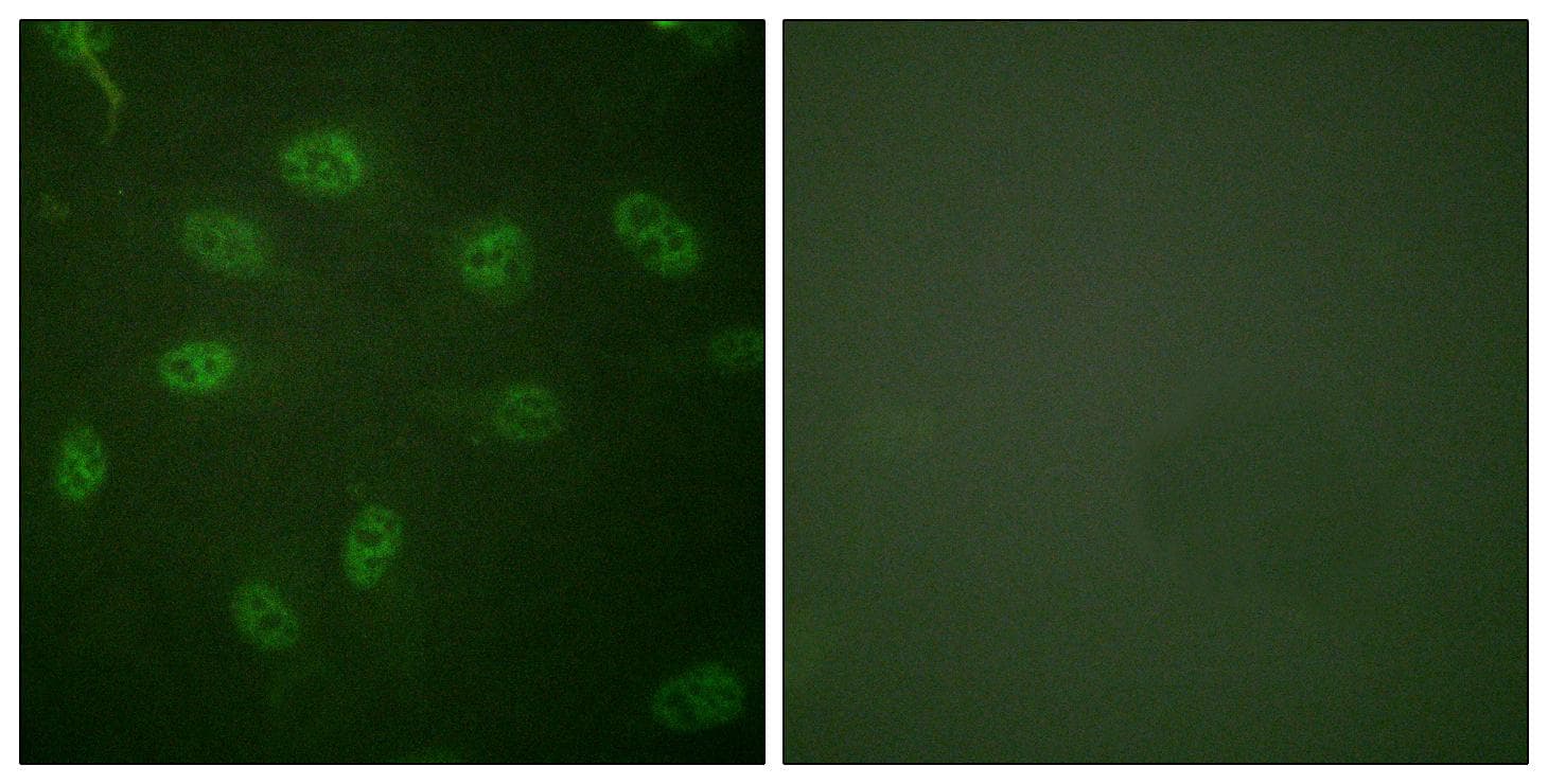 Polyclonal Rabbit anti-Human GATA4 Antibody (p105, IF, WB)
