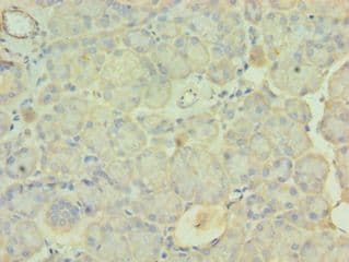 PDLIM1 Antibody (aa1-329)
