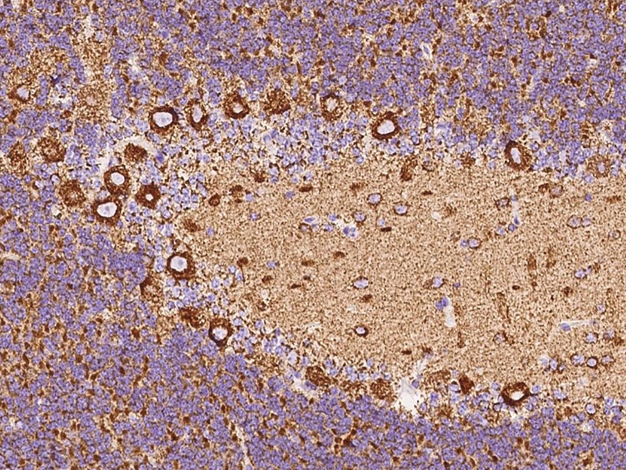 Polyclonal Rabbit anti-Human VDAC2 Antibody (IHC, IF, WB)