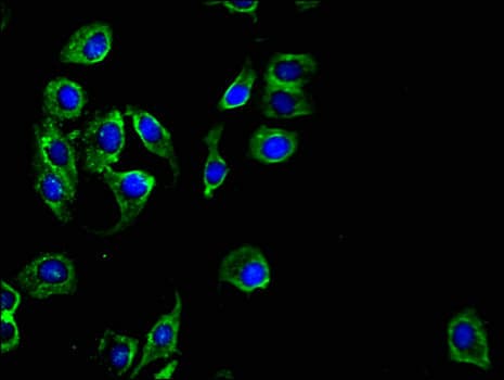 Polyclonal Rabbit anti-Human PKD1L3 Antibody (IHC, IF)