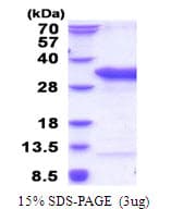 Human TSR2 Protein (Recombinant His)