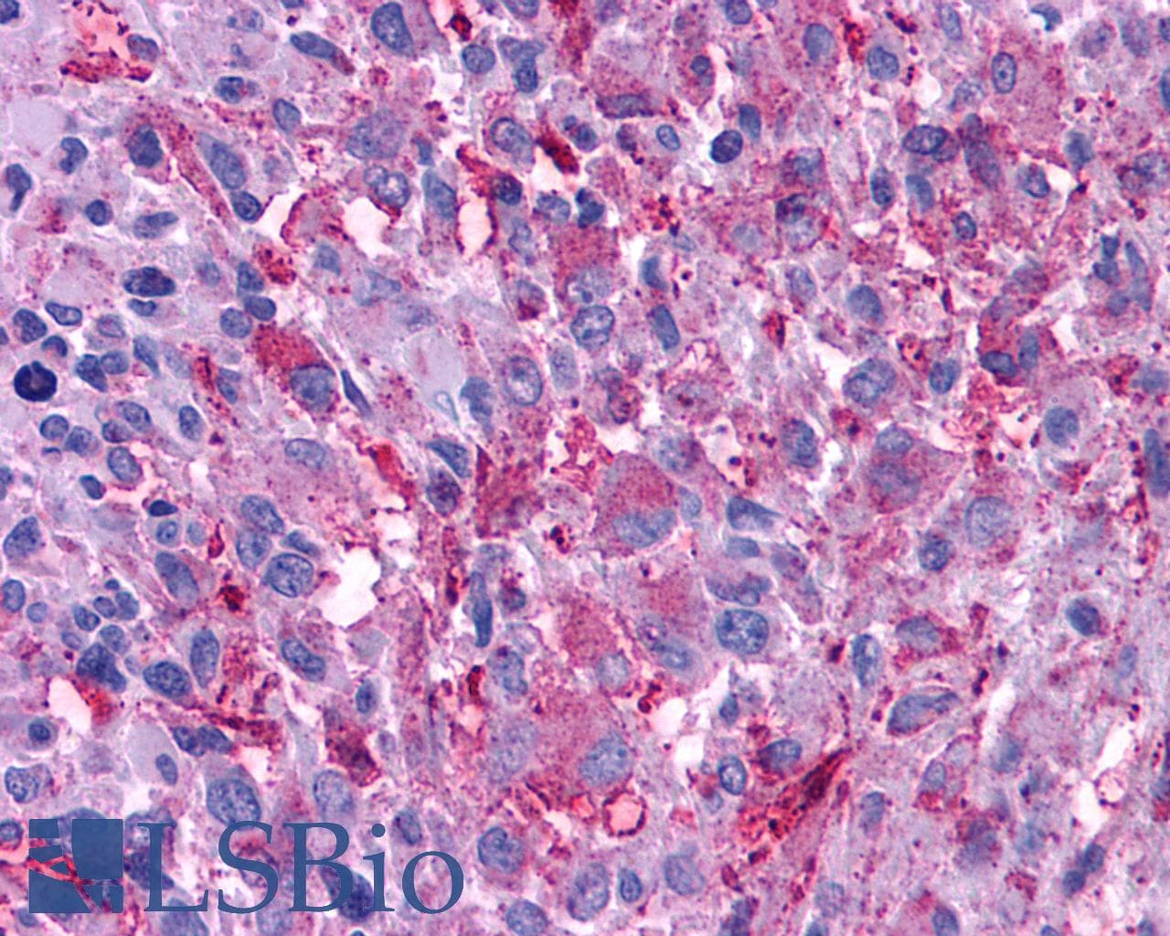 PathPlus™ Polyclonal Rabbit anti-Human VPAC2 / VIPR2 Antibody (C-Terminus, IHC)