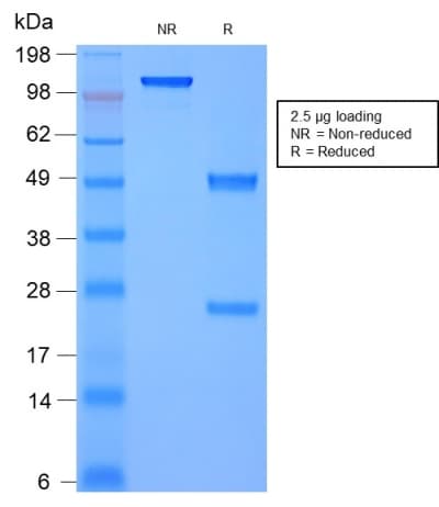 MSN / Moesin Antibody (clone rMSN/492, Azide-free, Carrier-free)