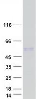 Human CDCP2 Protein (Recombinant Myc-DDK (Flag))