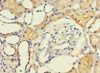 Polyclonal Rabbit anti-Human LRCH1 Antibody (IHC, IF, WB)