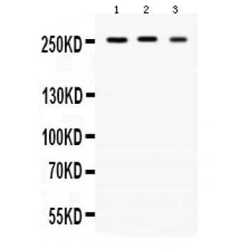 Polyclonal Rabbit anti-Human SCN1A / Nav1.1 Antibody (aa1981-2009, WB)