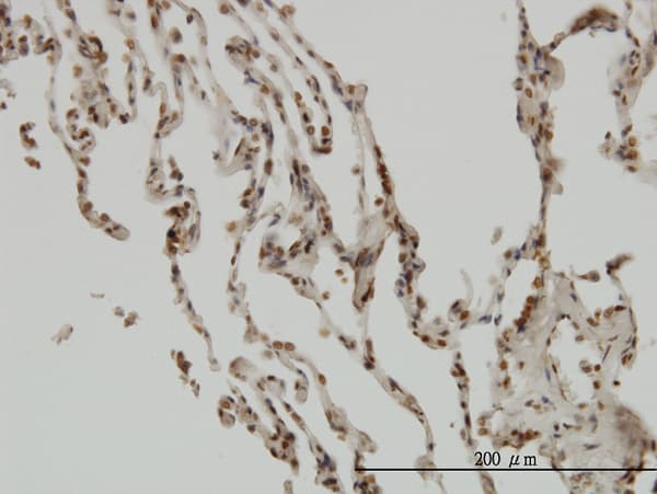 NFKBIB / IKB Beta / IKBB Antibody (clone 1B5)