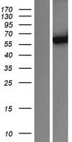 CYP3A4 / Cytochrome P450 3A4 Protein (Over-Expression Lysate Myc-DDK (Flag))