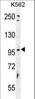 Polyclonal Rabbit anti-Human TAS1R2 / T1R2 Antibody (aa691-718, WB)