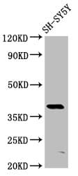 Polyclonal Rabbit anti-Human MKX Antibody (IHC, IF, WB)