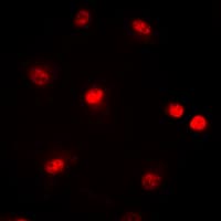 CREBBP / CREB Binding Protein Antibody (Internal)