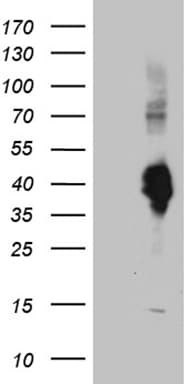 CLEC10A / CD301 Antibody (aa181-293, clone OTI2B10)