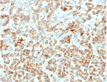 FXN / Frataxin Antibody (clone FDAX-1)