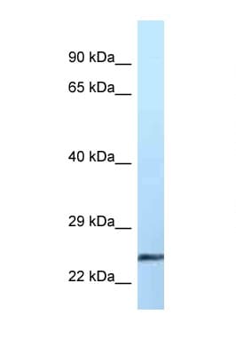 EFNA2 / Ephrin A2 Antibody (aa76-125)