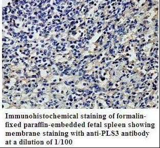 Polyclonal Rabbit anti-Human PLS3 / T Plastin Antibody (aa235-456, IHC, WB)