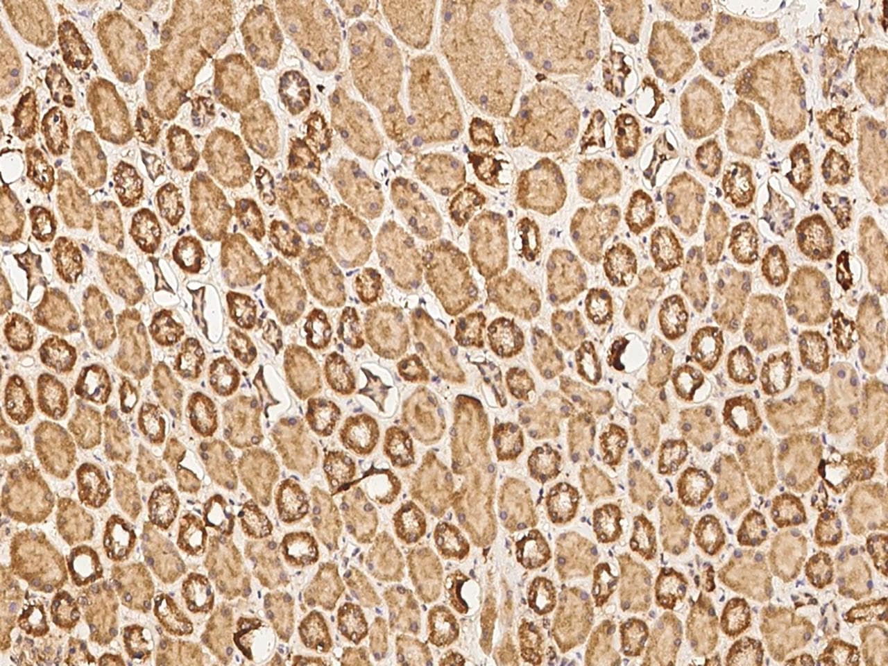Polyclonal Rabbit anti-Human HAS1 / HAS Antibody (IHC)
