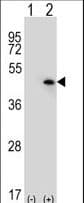 USP12 Antibody (aa315-345)