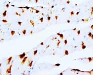 DUT / DUTPase Antibody (Internal, Sepharose)