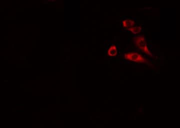 Polyclonal Rabbit anti-Human ANO9 / TMEM16J Antibody (IHC, IF, WB)