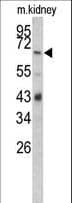 CFB / Complement Factor B Antibody (aa469-494)