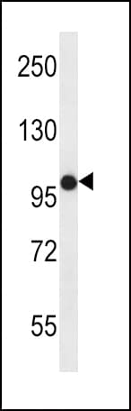 FGFR2 / FGF Receptor 2 Antibody (aa22-51)