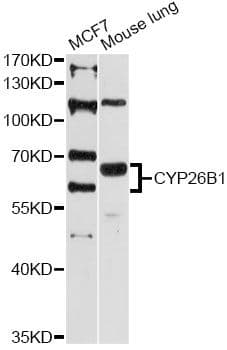 Polyclonal Rabbit anti-Human CYP26B1 Antibody (WB)