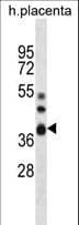 NT5C3B / NT5C3L Antibody (aa70-98)