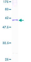 Human PVRIG Protein (Recombinant GST)