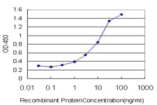 Monoclonal Mouse anti-Human CACNA1S / Cav1.1 Antibody (clone 2C5)