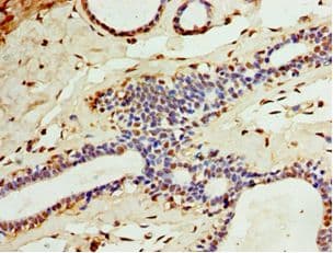 Polyclonal Rabbit anti-Human CA8 / Carbonic Anhydrase VIII Antibody (aa1-290, IHC, WB)